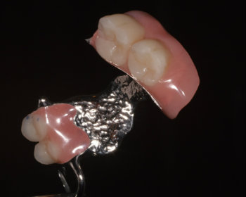 Partial Denture services page
